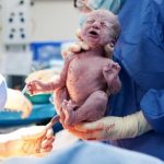 Кесарево сечение: что необходимо знать